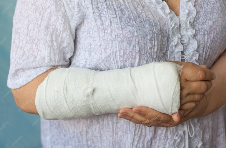 К чему снится сломанная рука